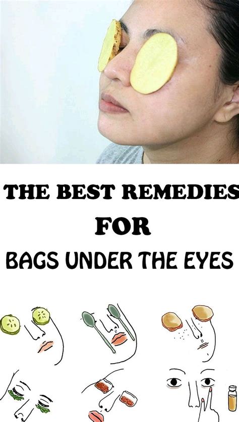 how to make fake bags under your eyes|diy eye bag removal remedies.